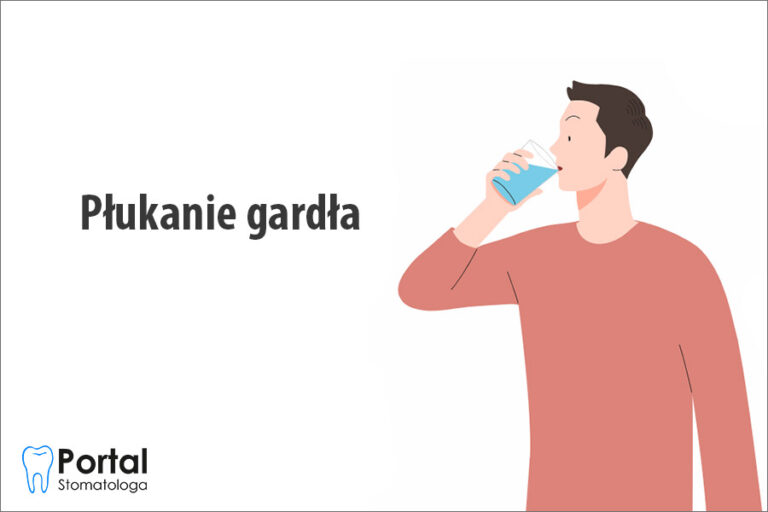 Płukanie gardła