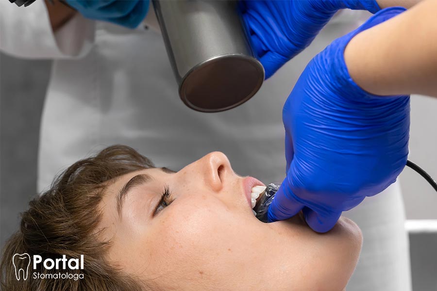 Zdjęcia wewnątrzustne