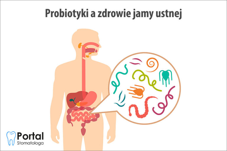 Probiotyki a zdrowie jamy ustnej