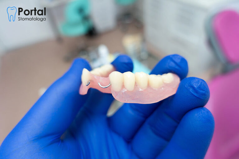 Rehabilitacja protetyczna