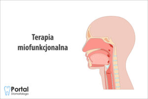 Terapia miofunkcjonalna