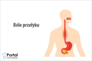 Bóle przełyku