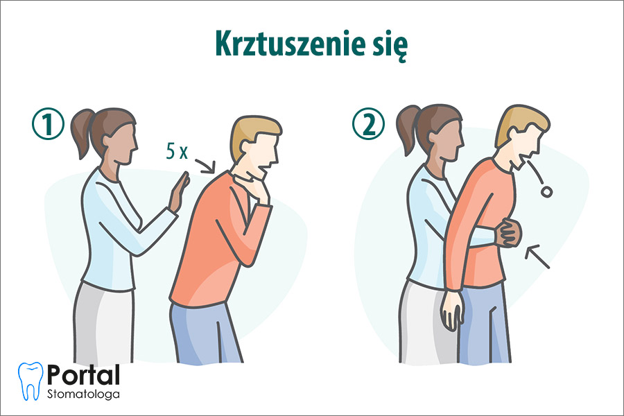 Krztuszenie się Krztuszenie się