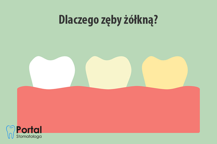 Dlaczego zęby żółkną?