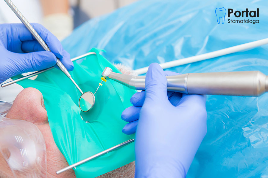 Ile kosztuje leczenie kanałowe w Polsce? Ile kosztuje leczenie kanałowe w Polsce?