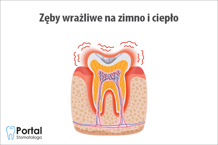 Zęby wrażliwe na zimno i ciepło