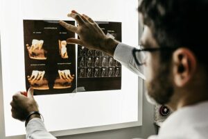 Nadwrażliwość zębów: Kiedy to chwilowy dyskomfort, a kiedy prawdziwy problem?