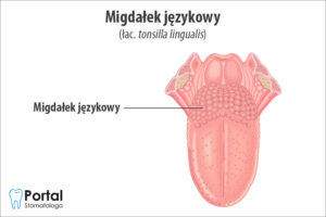 Migdałek językowy