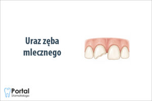 Uraz zęba mlecznego
