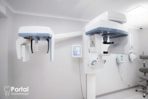 CBCT zębów