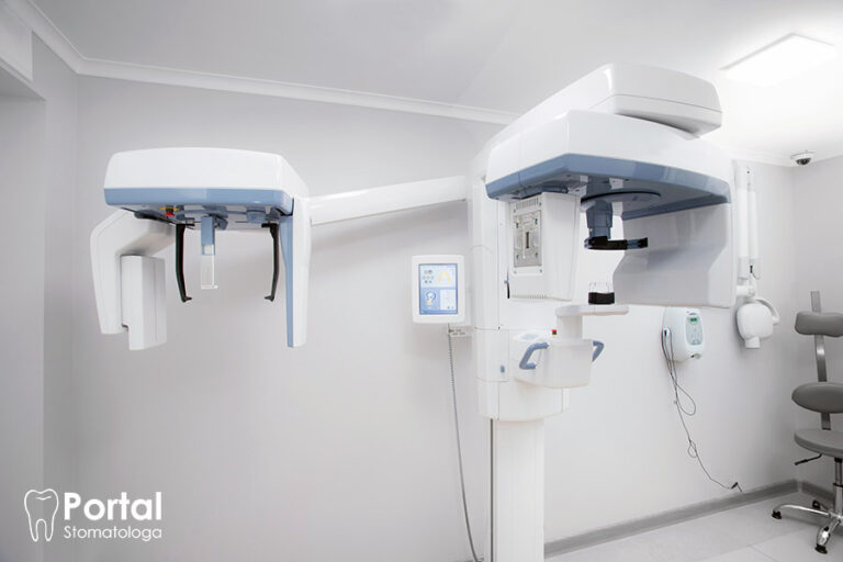 CBCT zębów