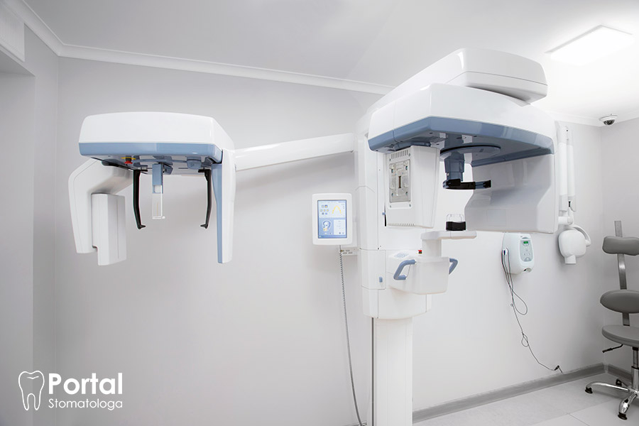 CBCT zębów