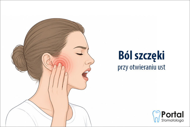 Ból szczęki przy otwieraniu ust