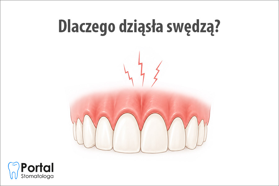 Dlaczego dziąsła swędzą?