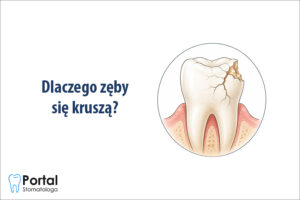 Dlaczego zęby się kruszą?