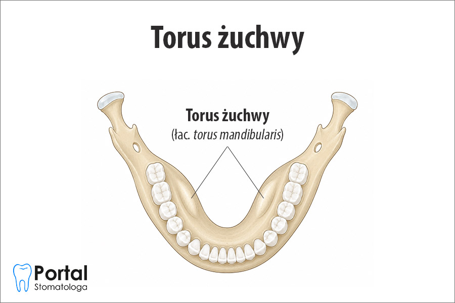 Torus żuchwy