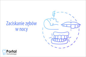 Zaciskanie zębów w nocy