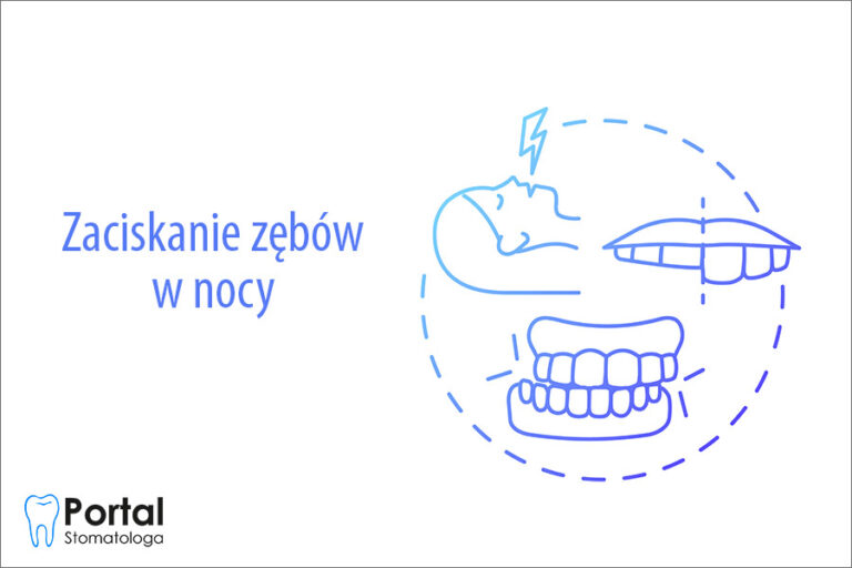 Zaciskanie zębów w nocy