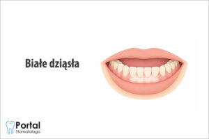 Białe dziąsła