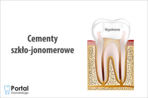 Cementy szkło-jonomerowe
