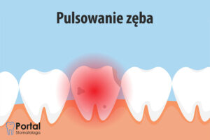 Pulsowanie zęba