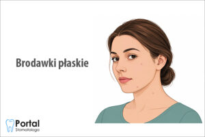 Brodawki płaskie