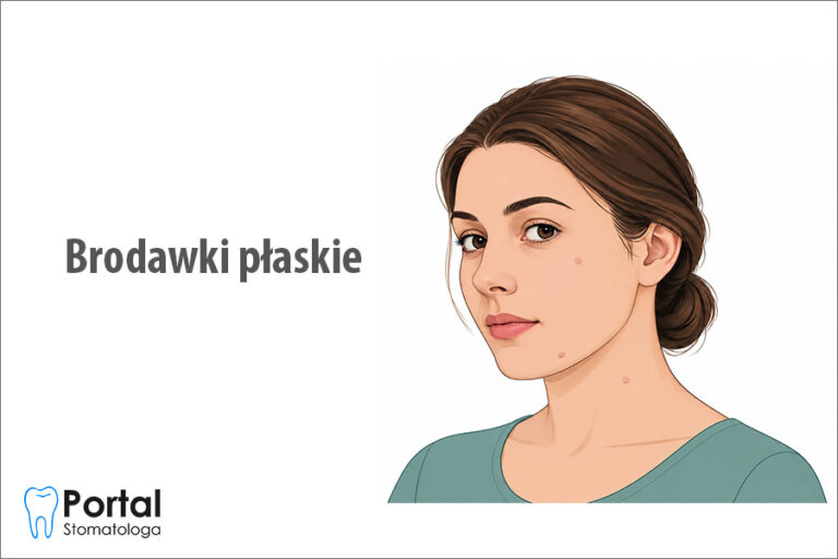 Brodawki płaskie