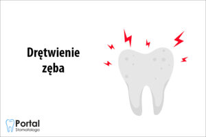 Drętwienie zęba