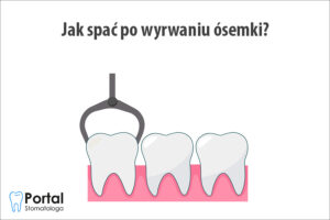 Jak spać po wyrwaniu ósemki?