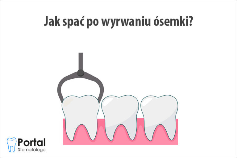 Jak spać po wyrwaniu ósemki?