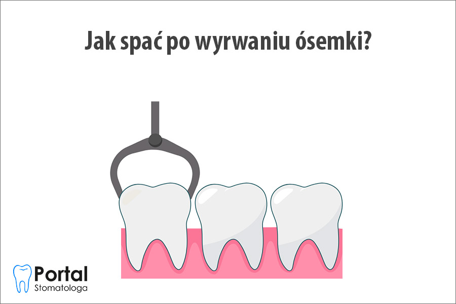 Jak spać po wyrwaniu ósemki?