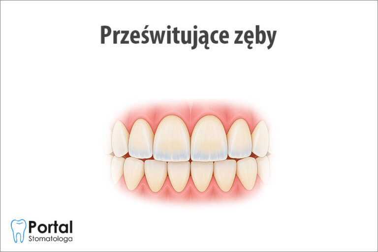 Prześwitujące zęby