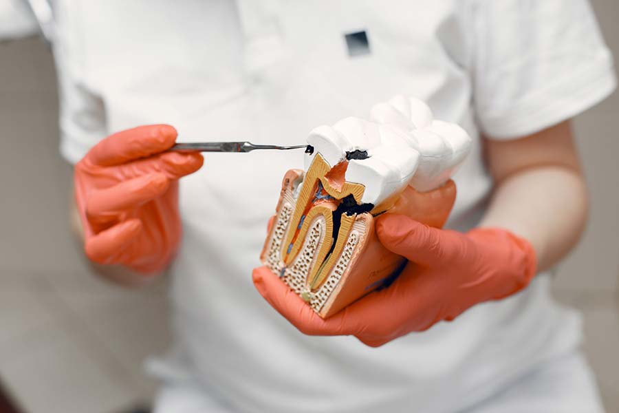 Resekcja, hemisekcja czy implant? Co wybrać, gdy leczenie kanałowe zawiodło Resekcja, hemisekcja czy implant? Co wybrać, gdy leczenie kanałowe zawiodło