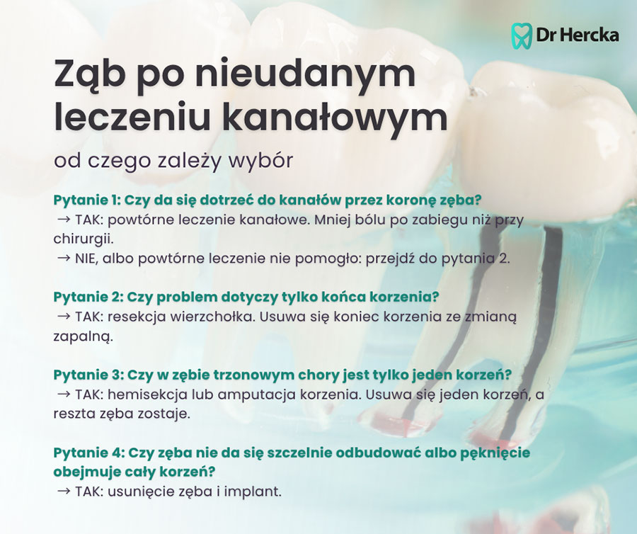 Resekcja, hemisekcja czy implant? Co wybrać, gdy leczenie kanałowe zawiodło
